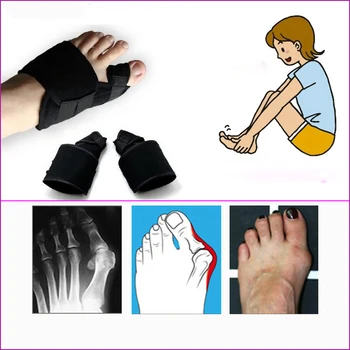 Bunion Korektoru, Kaulu Hallux Valgus Sāpju Foot Massager Lielā Pirksta Atdalītājs Ortopēdiskie Piederumi Aizsargs Kāju Kopšanas Līdzeklis